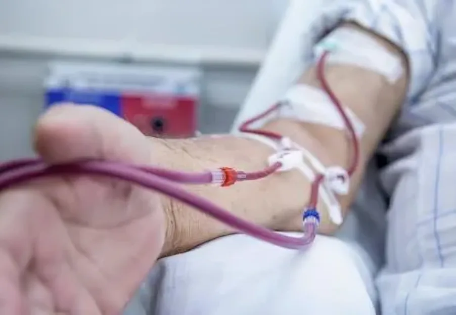 Accesos vasculares para enfermedad renal